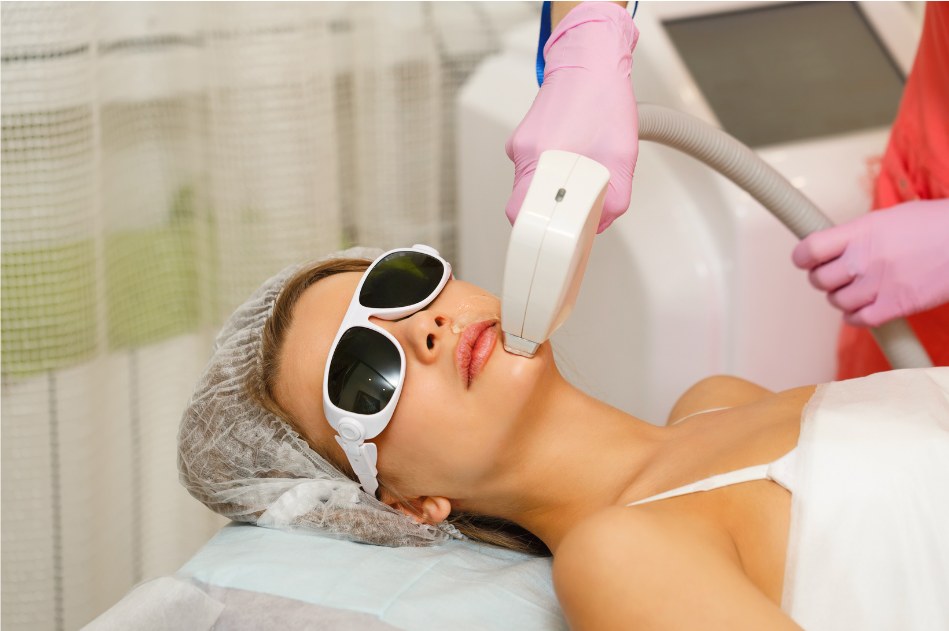 Dermatologist performing diode laser hair removal on a patient's chin at Clear Skin Clinic