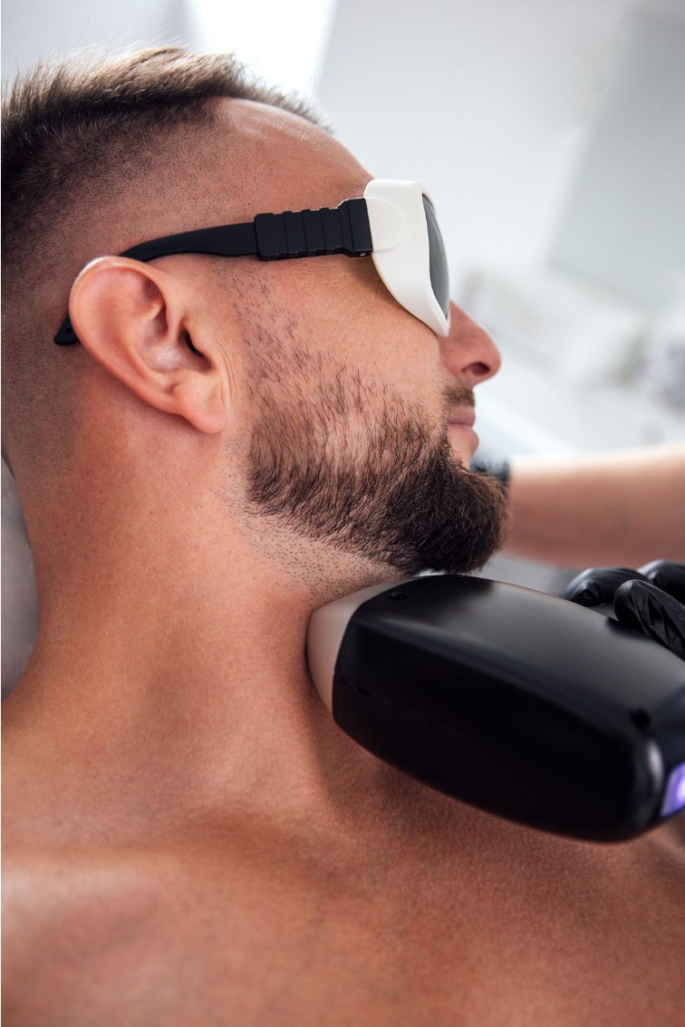 Male patient undergoing laser hair removal on the beard and neck area at Clear Skin Clinic