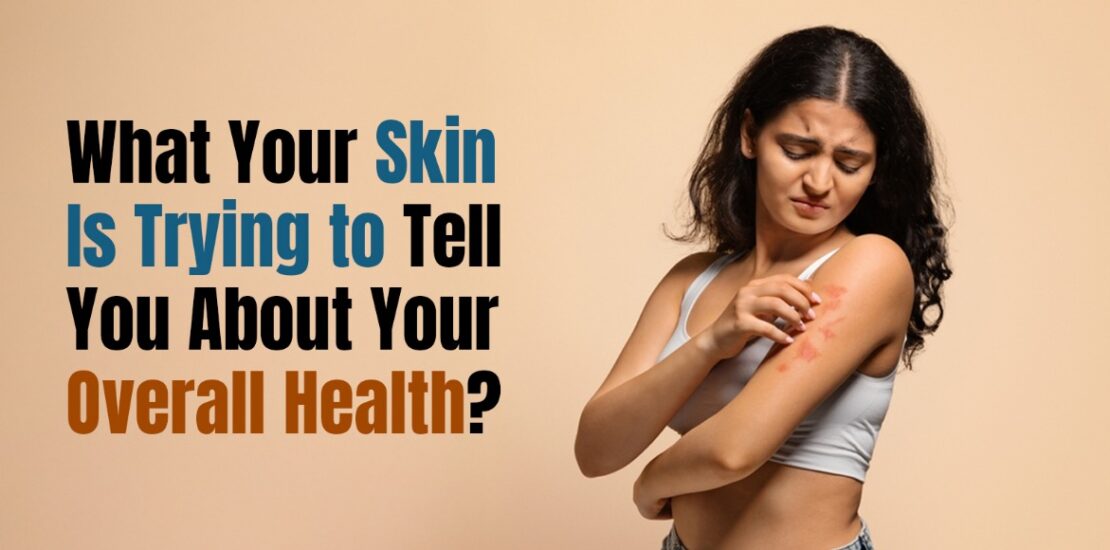 Your Skin Is Trying to Tell You About Your Overall Health