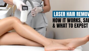 laser hair removals