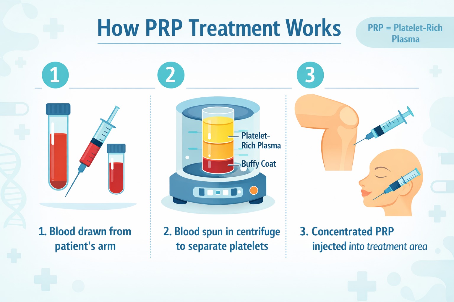 PRP treatment work