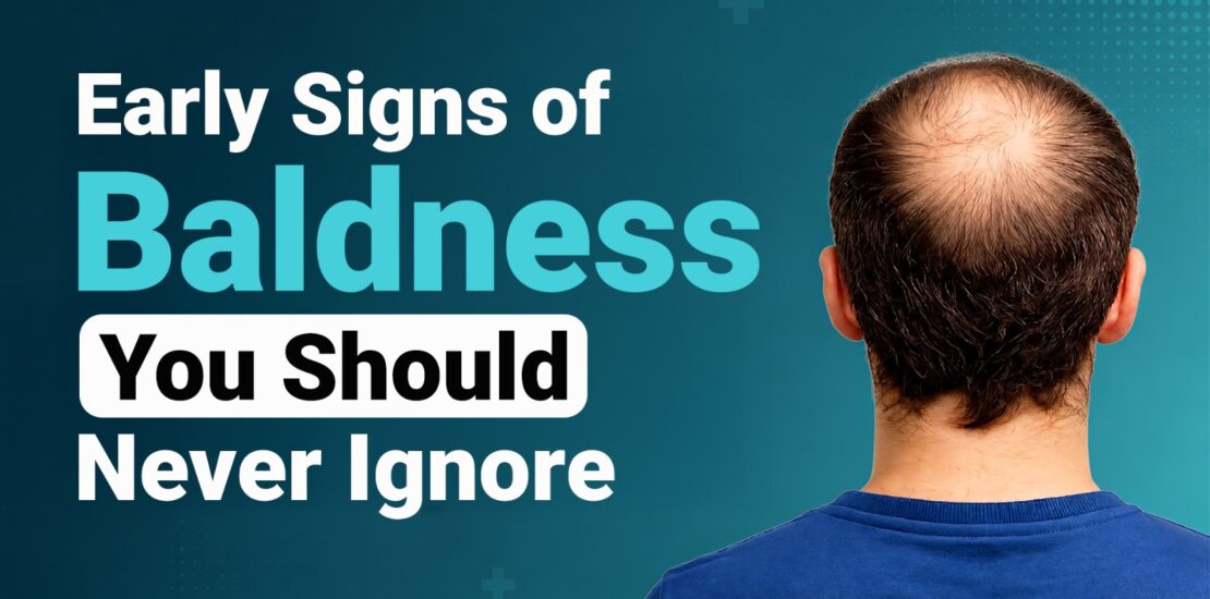 Early Signs of Baldness You Should Never Ignore