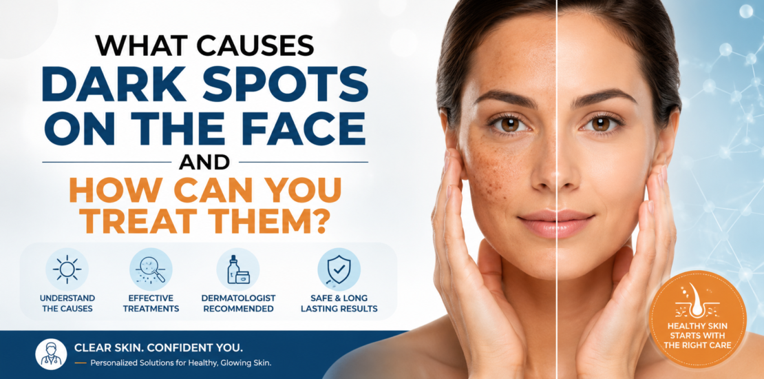 What Causes Dark Spots on the Face and How Can You Treat Them?