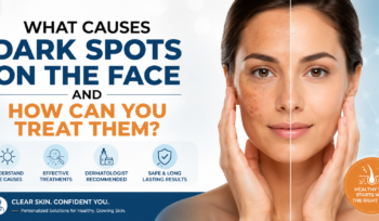 What Causes Dark Spots on the Face and How Can You Treat Them?