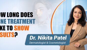 How Long Does Acne Treatment Take to Show Results?