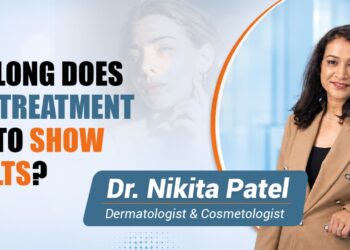 How Long Does Acne Treatment Take to Show Results?