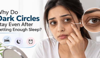 Why Do Dark Circles Stay Even After Getting Enough Sleep?