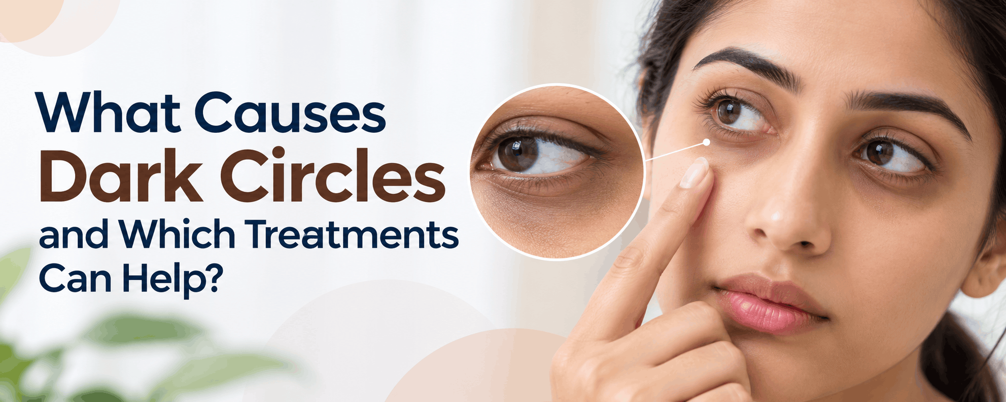 What Causes Dark Circles